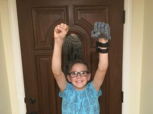 boy raises arms with artificial hand